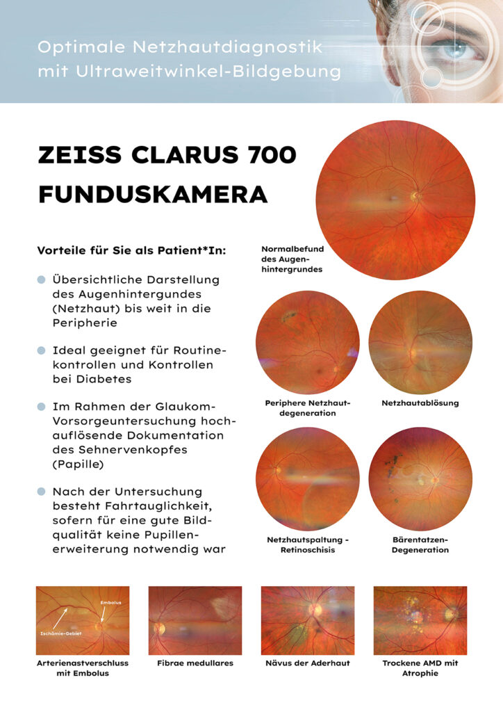 Zeiss Clarus 700 - Plakat